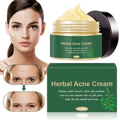 Biologische kruidengeneesmiddelen Acne Remover acnebehandeling reparatie littekencrème