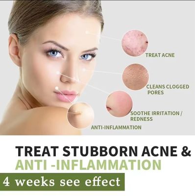 Biologische kruidengeneesmiddelen Acne Remover acnebehandeling reparatie littekencrème