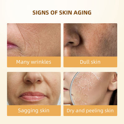 OEM ODM 6X Retinol Vocht Kalmerend Blekend Anti Rimpel Anti Ageing Gezichtshuid Toner