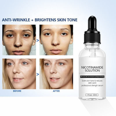 اسنس دارما Niacinamide Serum مراقبت از پوست قابل سفارشی کردن لکه های تیره سروم روشن کننده