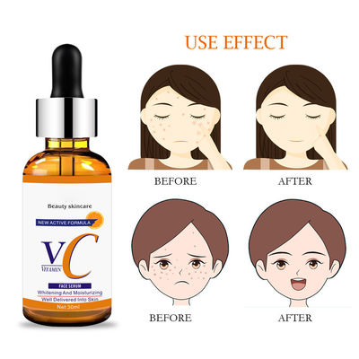 Sensation de lumière sur le visage sérum énergie radiante VC polypeptide essence