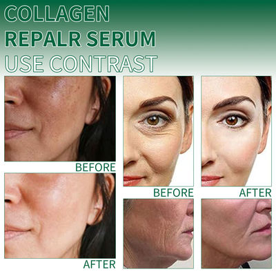 Collageen Gezicht Serum Hydraterende Kalmerende Huid Versterkende Serum Transparante Essence