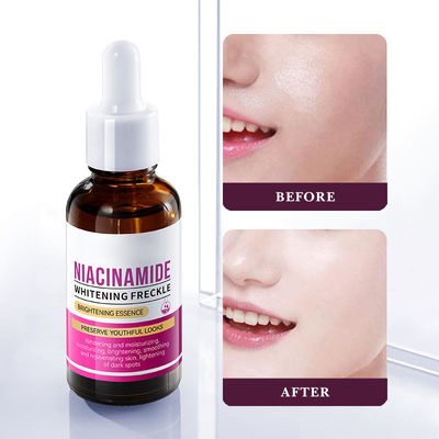 ODM OEM Beauty Essence Liquid Moisturizing Serum Nicotinamide Remove Freckle Whitening