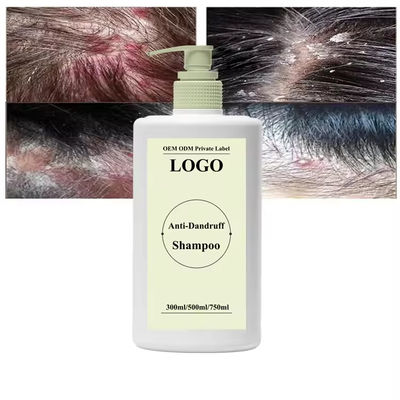 Olie Controle Anti Schilfer Anti Jeuk Shampoo Diep reinigende haar shampoo