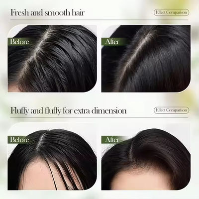 Olie Controle Anti Schilfer Anti Jeuk Shampoo Diep reinigende haar shampoo