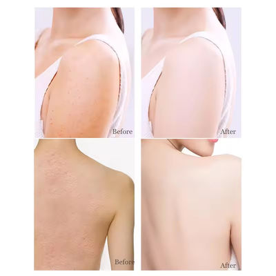 Naturale Avena Organica Niacinamide Body Scrub Esfoliante Anti-Aging Cellulite Dead Scrub