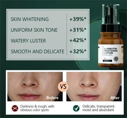 Gezichtsverzuiverende lotion Alpha Arbutin Donkere vlekken Gezichtscrème Lotion Huidverzorging Gezichtslotion