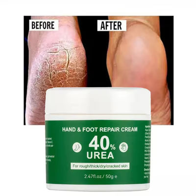 OEM Vitamine E Voetverzorging Anti-droging Vaseline Urea Creme Voetverzorging