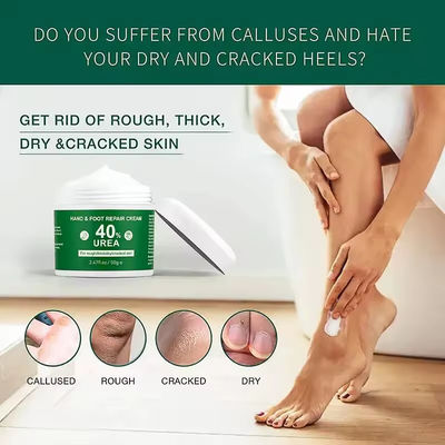 OEM Vitamine E Voetverzorging Anti-droging Vaseline Urea Creme Voetverzorging