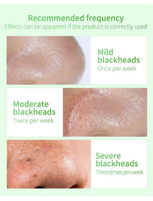 Eliminatore di punti neri siero naturale organico anti-invecchiamento riparazione del viso siero cura della pelle