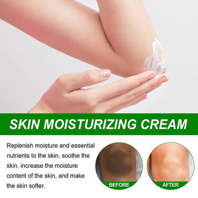 몸 의 하얀색 크림 하얀색 혈청 멜라닌 색소 제거 안쪽 허벅지 피부 가늘 해주는 크림