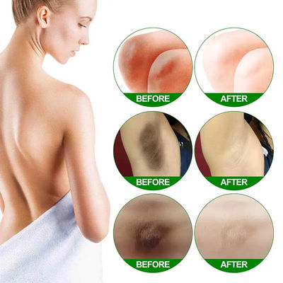몸 의 하얀색 크림 하얀색 혈청 멜라닌 색소 제거 안쪽 허벅지 피부 가늘 해주는 크림