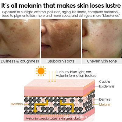Crema para el rostro Blanqueador Hidratante Antienvejecimiento Acné Vitamina C Crema para eliminar manchas negras