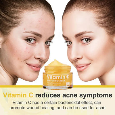 Crema para el rostro Blanqueador Hidratante Antienvejecimiento Acné Vitamina C Crema para eliminar manchas negras