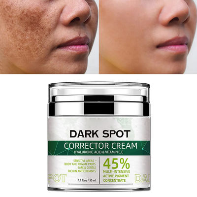 Gezicht Zwarte sproeten Acne Vervagen Donkere vlekken Verwijder corrector Bleekcrème