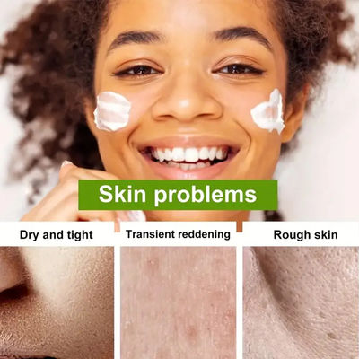 Kem dưỡng ẩm tự nhiên Vitamin E Aloe Vera Kem chống lão hóa sửa chữa khuôn mặt