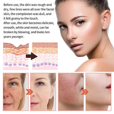Serum do pielęgnacji skóry 5 w 1 Serum do wybielania ciemnych plam Serum witaminy C Serum do pielęgnacji twarzy