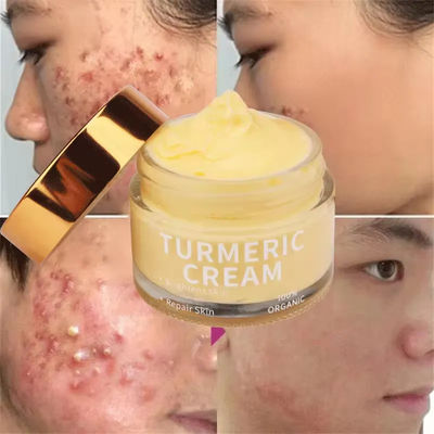 Chăm sóc da hữu cơ mụn nhăn nhăn điểm đen ẩm làm trắng nghệ kem mặt
