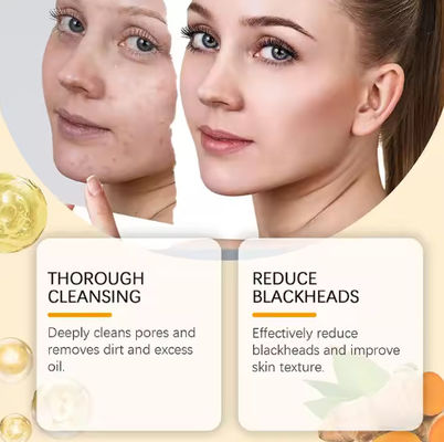 OEM Private Label Kojicumzuur Schoon en helder huidverhelderend schuimend gezicht wassen Kurkuma schuimreiniger voor donkere vlekken acne