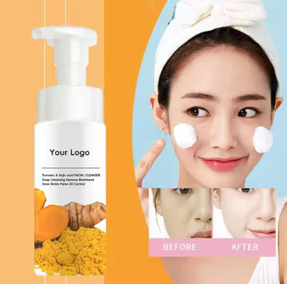 Kurkuma Kojic Acid Mousse Schoonmaak Schone huid Niacinamide Verblindend Schuimend Gezichtswasmiddel voor Donkere Vlekken Huid