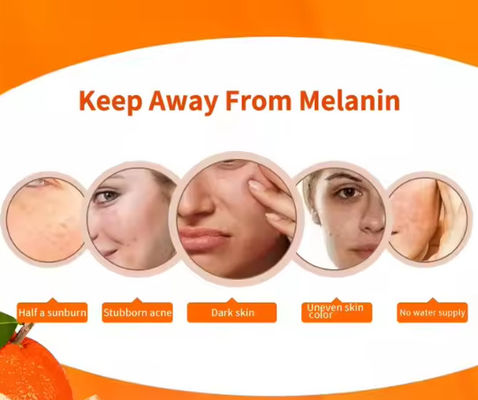 Crema per il viso Crema anti-invecchiamento e acido ialuronico Vitamina C Crema per il viso per la rimozione del melasma