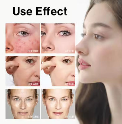 Vendita a caldo Tonico esfoliante con acido glicolo 7% Rimozione dell' acne Tonico per la cura della pelle del viso Tonico per la cura della pelle