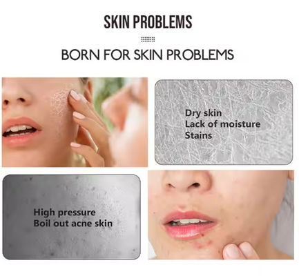 Soins de la peau de marque privée Spray de brouillard pour le visage Calmant hydratant apaisant pour le visage Vitamine C Curcuma tonifiant la peau