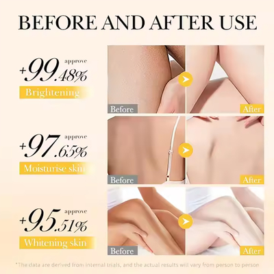 Zerdeçal C Vitamini Beyazlatıcı Vücut Losyonu Akne Karşıtı Nemlendirici Beyazlatıcı Vücut Losyonu Kadınlar İçin C Vitamini Retinol Vücut Losyonu