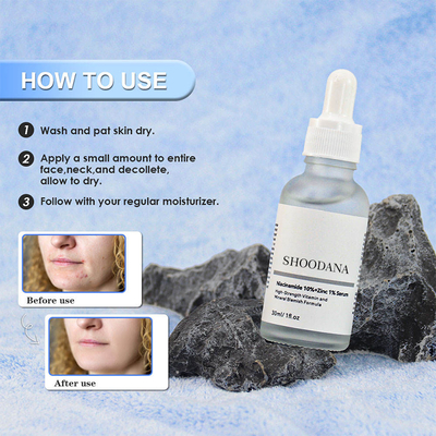 10% Niacinamide 1% Zinc Facial Serum Dark Spot Correcting Face Serum Brightening Facial Skincare