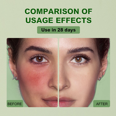 Anti Wrinkle Moisturizing Collagen Anti-aging Whitening Facial Serum with Hyaluronic Acid Vitamin E
