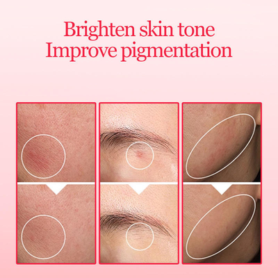 Face Serum Brightening Serum with 10% Niacinamide and 4% TXA Dark Spot Correcting Serum