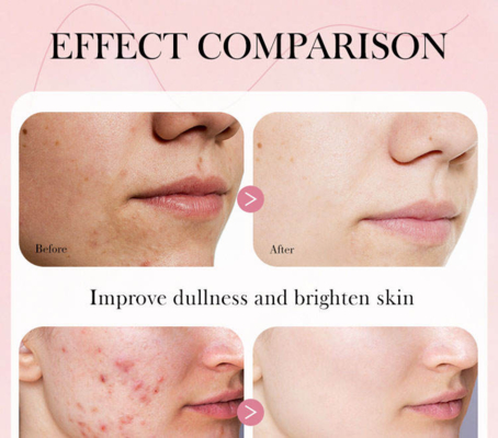 Private Label Hyaluronic Acid Niacinamide Face Serum Polyglutamic Acid Dark Spot Remover for Face Hydrate Moisturize Brighten