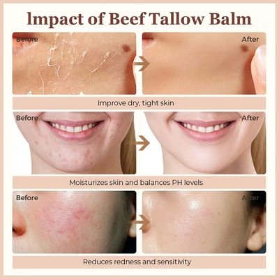 Private Label Organic Vegan Beef Tallow Balm Hydrating Repairing Anti-Aging Skincare Facial Moisturizer Herbal Face Cream
