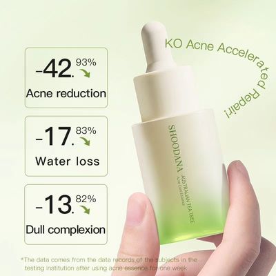 Green Tea Acne Serum Pore Shrinking Facial Oil Control Treatment for Oily Skin Anti-Aging Whitening Gold Stamping Logo OEM
