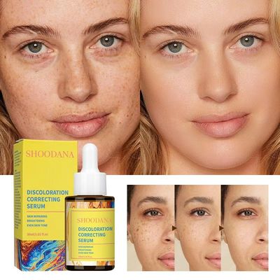 Skin Care Dark Spot & Discoloration Correcting Serum with Niacinamide Vitamin C & Hyaluronic Acid 30ml for Face Pore Shrink
