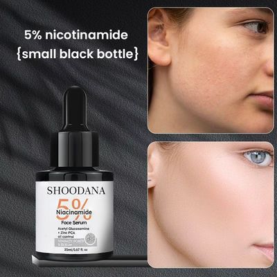 OEM Private Label Beauty Face 5% Niacinamide Zinc PCA Fine Pore Balance Grease Brightening Whitening Anti-Aging Skincare Facial