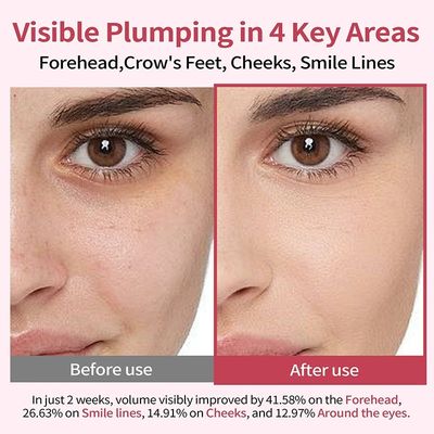 OEM Private Label PDRN Collagen Peptides Hyaluronic Acid Anti-Wrinkle Plumping Serum Glowing Hydrating Firming Skincare